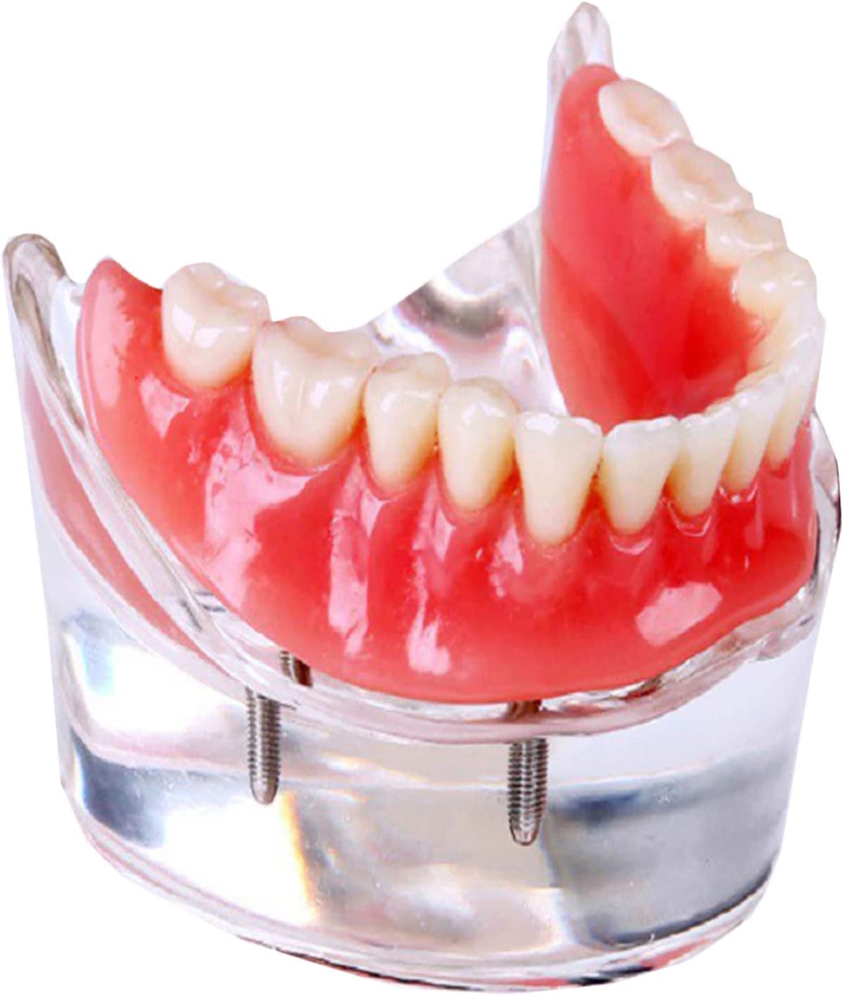 Modello Anatomico, Modello Scheletrico, Modello di Denti Implantari, Modello Didattico per Studio Odontoiatrico, per Protesi su Impianti E Unghie, Modello di De