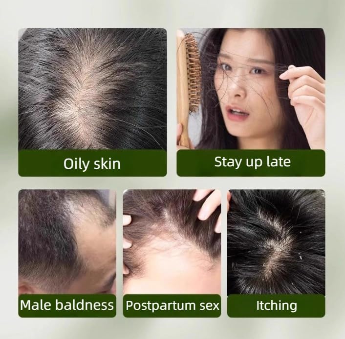 Miniatura 6 de Nature Triangle Barra de champú, champú de jabón verde Nature Seve, barra de hierba Usman Grass, para mujeres y hombres (2 unidades)