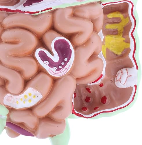 Miniatura 4 de Modelo de Patología Gastrointestinal Humana Modelo de Tracto Digestivo Coronal Gástrico para Estudiantes Escolares Aprendizaje