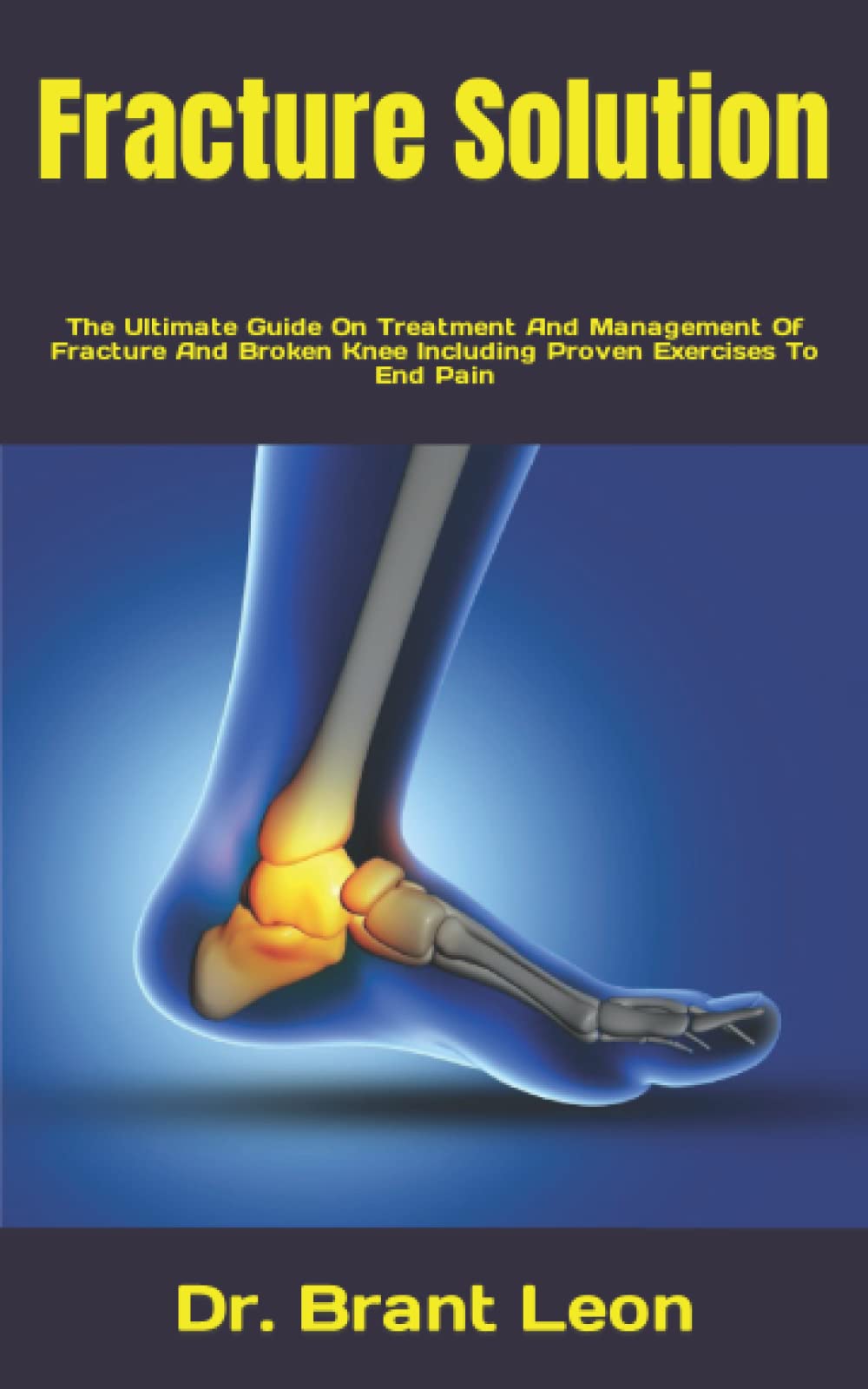 Buy Fracture Solution: The Ultimate Guide On And Management Of Fracture ...