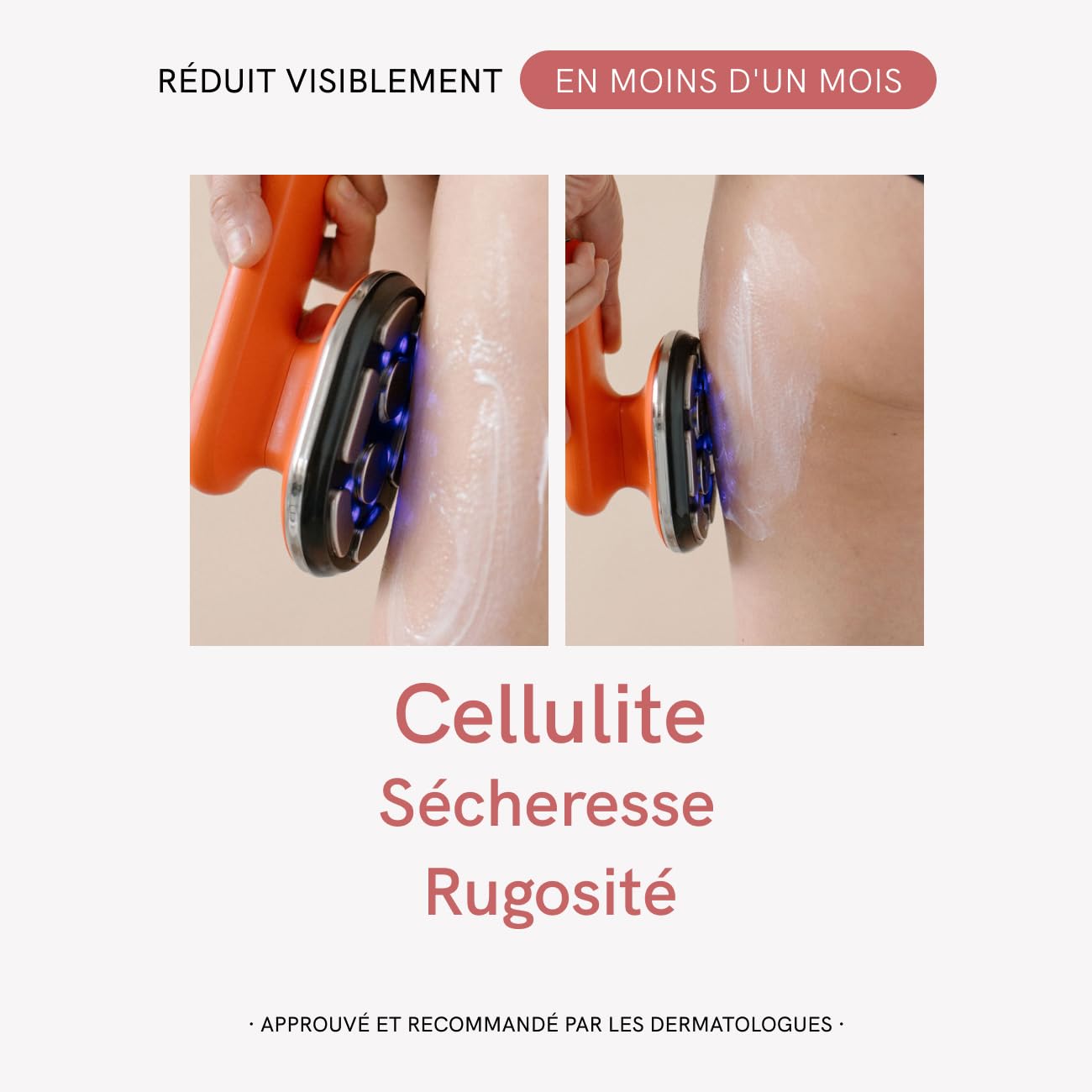 MASDERM - Cellulite 2-en-1, Appareil Radiofréquence Corporelle Professionnel avec Crème Anti-Cellulite Raffermissante 500 ml et Technologie EMS LED, Traitement Réducteur et Anti-Graisse - Pack de 2