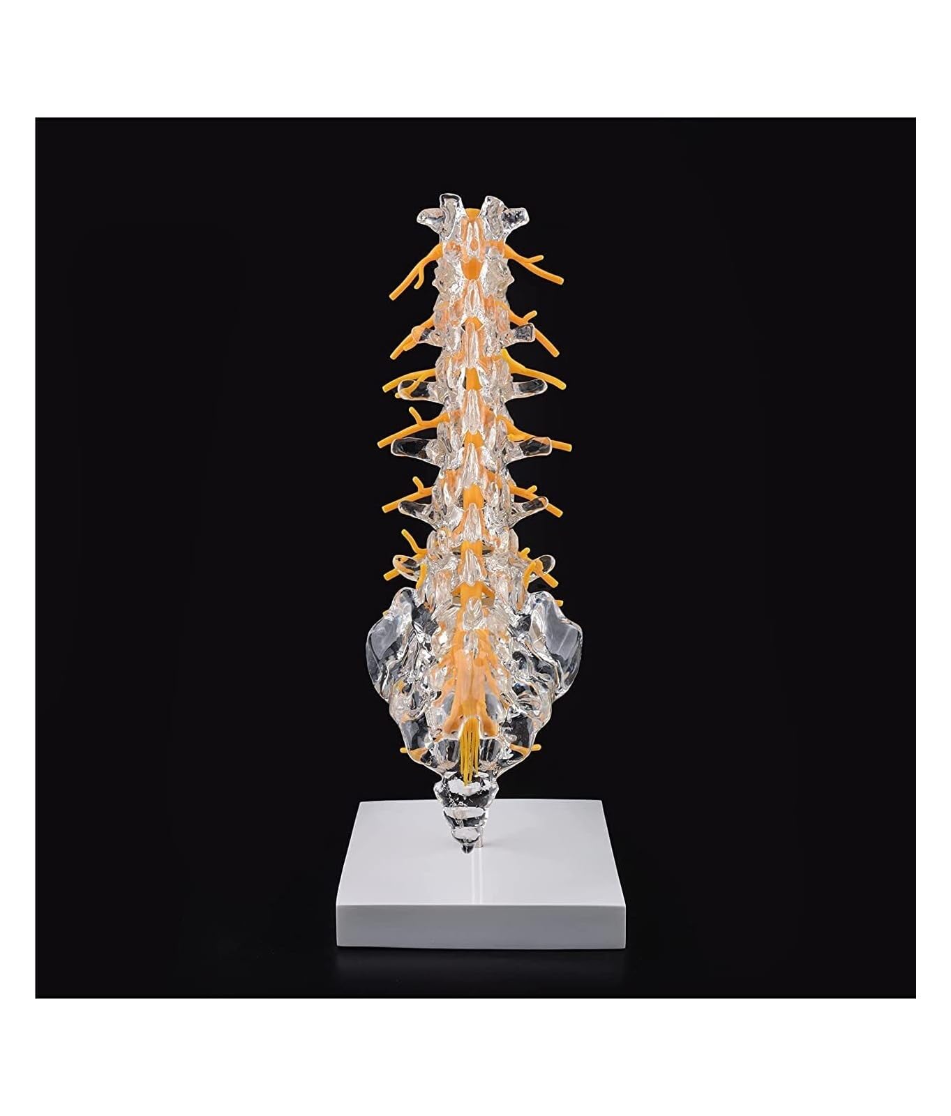 Nervi spinali ed ernia del disco da esporre, modello di colonna vertebrale umana trasparente Modello di colonna vertebrale lombare umana con sacro