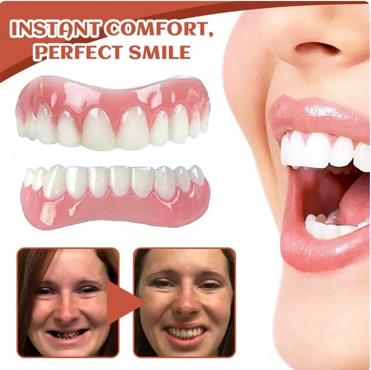 Prothese Dentaire Silicone,Dentier Silicone,Bikenda Prothese Dentaire Silicone,1 Upper Dental Device + 1 Lower Dental,Pour Hommes Et Femmes, Sourire Naturel au Quotidien，3Pcs