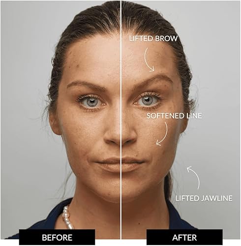 Miniatura 6 de ZIIP Dispositivo de tonificación facial Halo  Dispositivo facial de microcorriente y nanocurrente  Fortalecimiento y escultura para una piel joven y