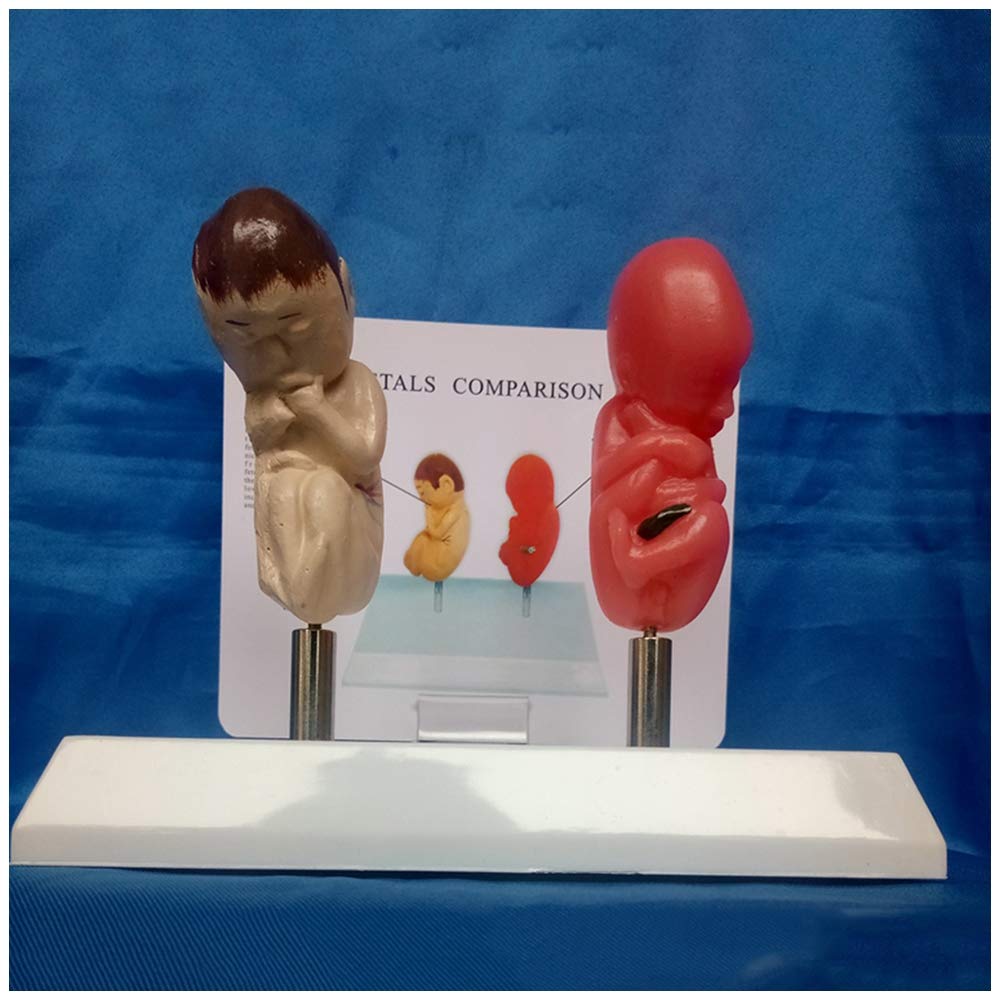 Model płodu-płód palący i normalny Model porównawczy płodu-materiał PCV modele naukowe anatomii człowieka-do wyświetlania w celach dydaktycznych model medyczny