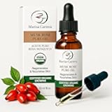 100% Certified Organic Growing Rosehip Oil/Aceite Puro De Rosa Mosqueta 30 Ml. / 1 Fl.oz.heals Dry Skin, Fine Lines, Acne Scars, Eczema, Psoriasis, Dermatitis, Sun Damage & More