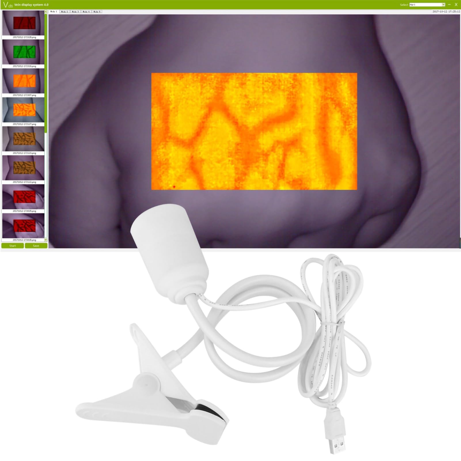 Vein Finder Vein Lights Imaging Viewer Display Machine for Adult Children