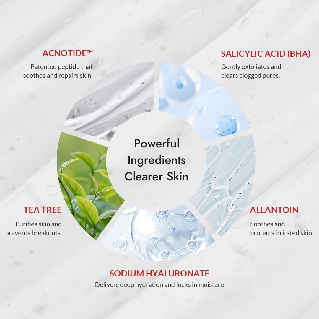 MIZON GoodByeBlemish Soothing Gel Cream with Acnotide, for Sensitive Skin, Breakout Treatment, Acne Spot Treatment (55ml 1.85 fl oz) - Image 4