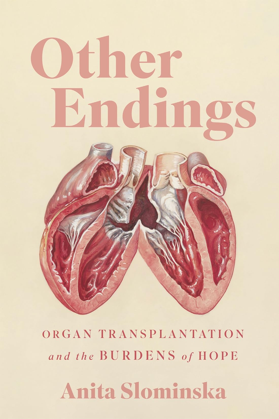 Other Endings: Organ Transplantation and the Burdens of Hope