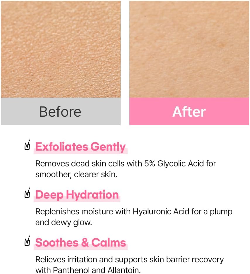 Hanskin Hyaluron Exfoliating AHA Treatment – Korean Exfoliating Toner with Glycolic & Lactic Acid for Smooth, Hydrated, Glass Skin | pH-Balanced Daily Skin Booster for Dull, Dry Skin, 5.07 fl oz - Image 6