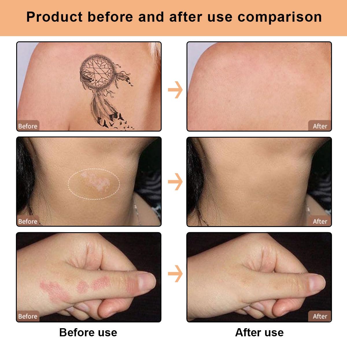 Tatuaggio Correttore,Crema Tatuaggio di Copertina,Copri Tatuaggi,Tattoo Concealer,Correttore per Coprire Tatuaggi,Copertina Make Up,Impermeabile,Coprire Tattoo Cicatrici,Macchie Scure,20g+20g