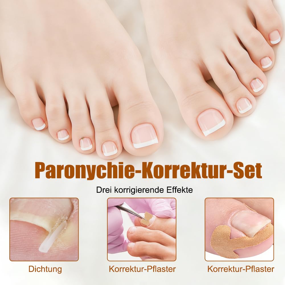 Zestaw do korekcji wrastających paznokci u stóp, 139 sztuk, z łatką do korekcji paznokci u stóp, wkładki do paznokci w kształcie litery C, zestaw narzędzi do pielęgnacji stóp – obcinacz do paznokci
