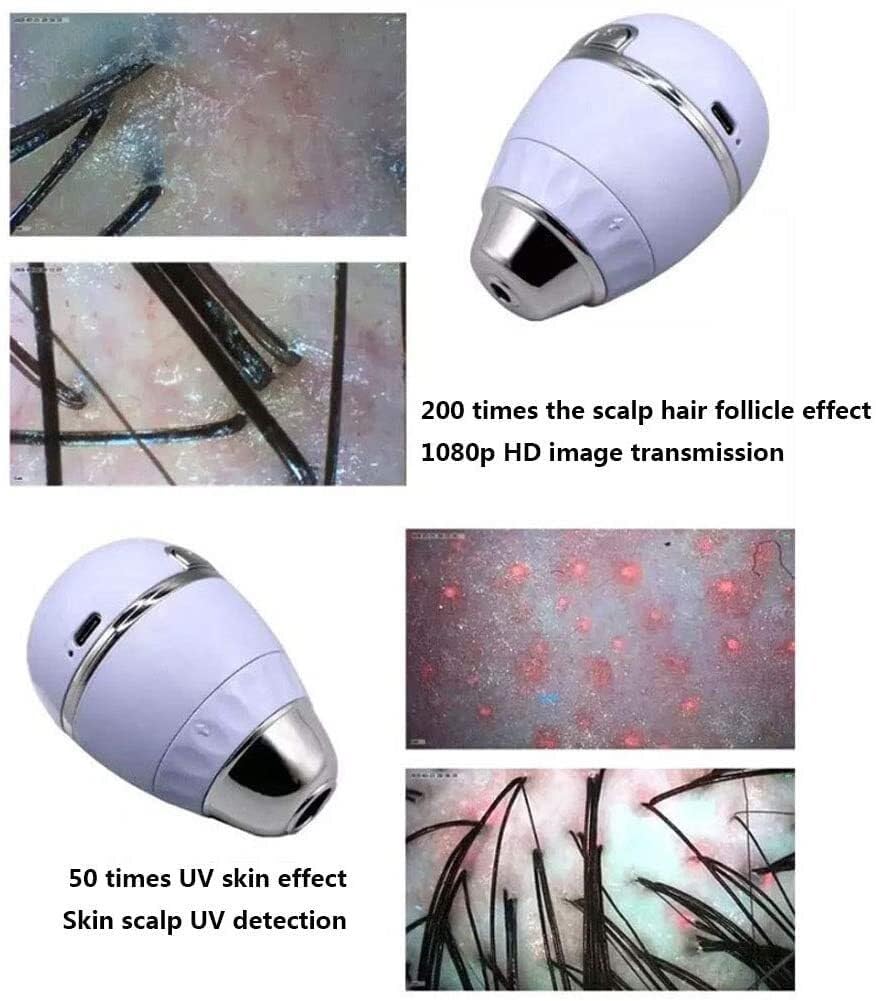 Analizzatore della salute della pelle con rilevatore del cuoio capelluto, schermo Ultra HD da 11 pollici con quattro funzioni di analisi dello spettro for la cura della pelle al microscopio, macchina