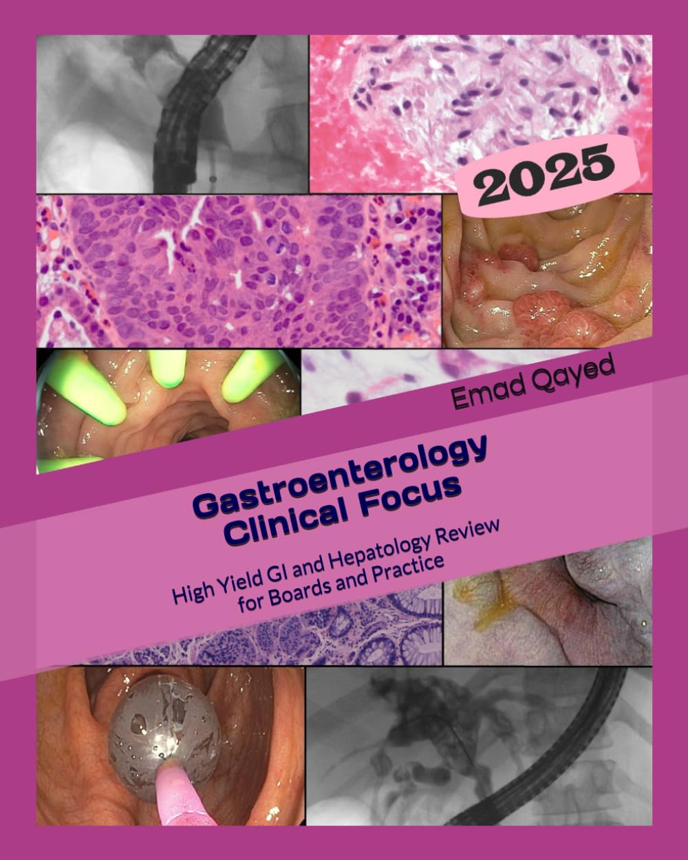 Gastroenterology Clinical Focus: High yield GI and hepatology review- for Boards and Practice - 3rd edition