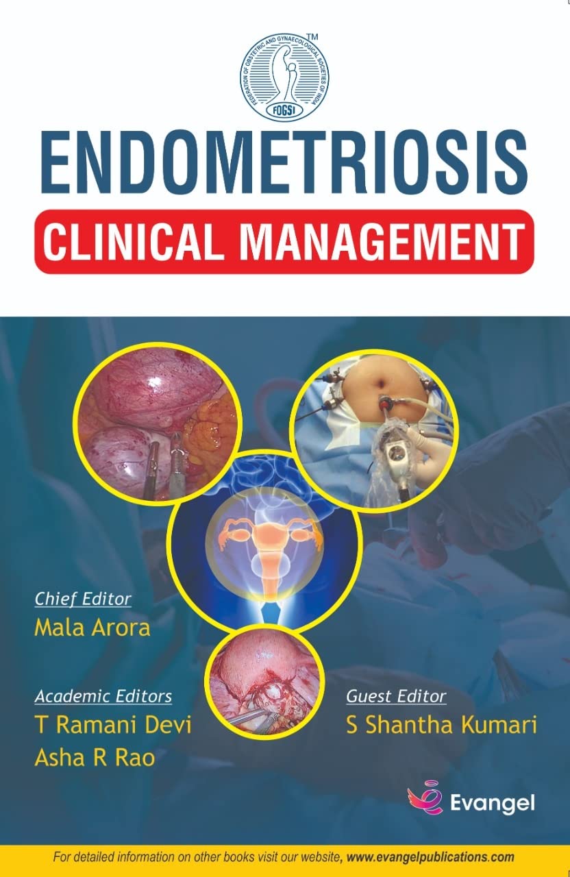 ENDOMETRIOSIS CLINICAL MANAGEMENT