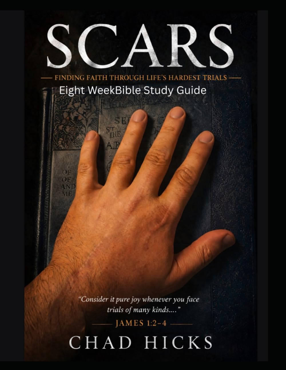 SCARS - Finding Faith Through Life's Hardest Trials: Eight-Week Bible Study Workbook