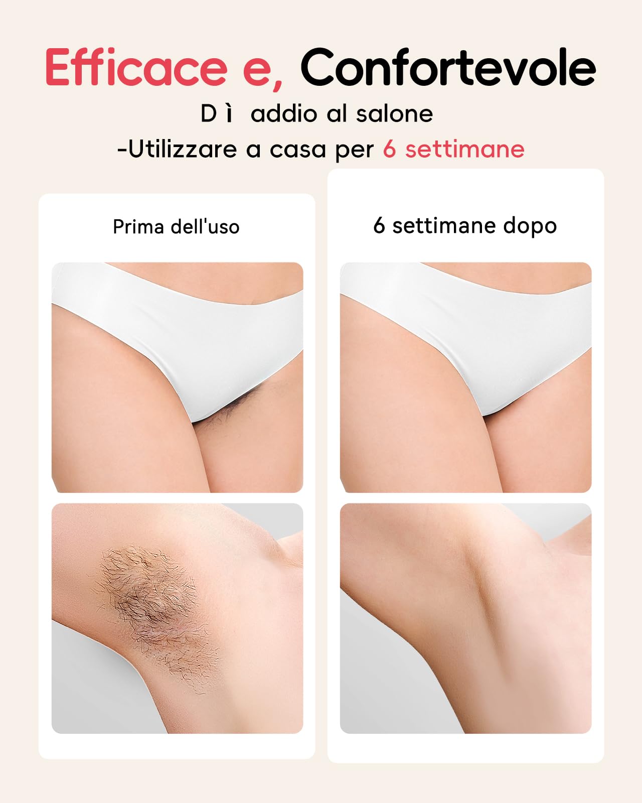 Haarlosy IPL Epilatore Luce Pulsata Indolore con Energia Massima 22J, Epilatore Laser con Tecnologia Innovativa IGBT, Adatto per Uomini e Donne Corpo, Viso, Ascelle, Gambe (Beige)