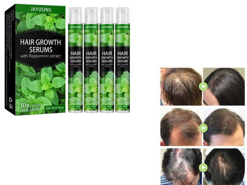 Herbal Hair Regrowth Spray, Hair-growth Essence Spray, Herbal Hair Growth Essence Spray, Hair Growth Treatement Germinal Oil, Hair Growth Maximizer Spray for Prevent Postpartum Hair Loss Men Women (10ml 4PC)