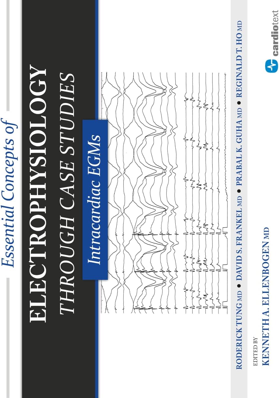 Essential Concepts of Electrophysiology Through Case Studies: Intracardiac EGMs