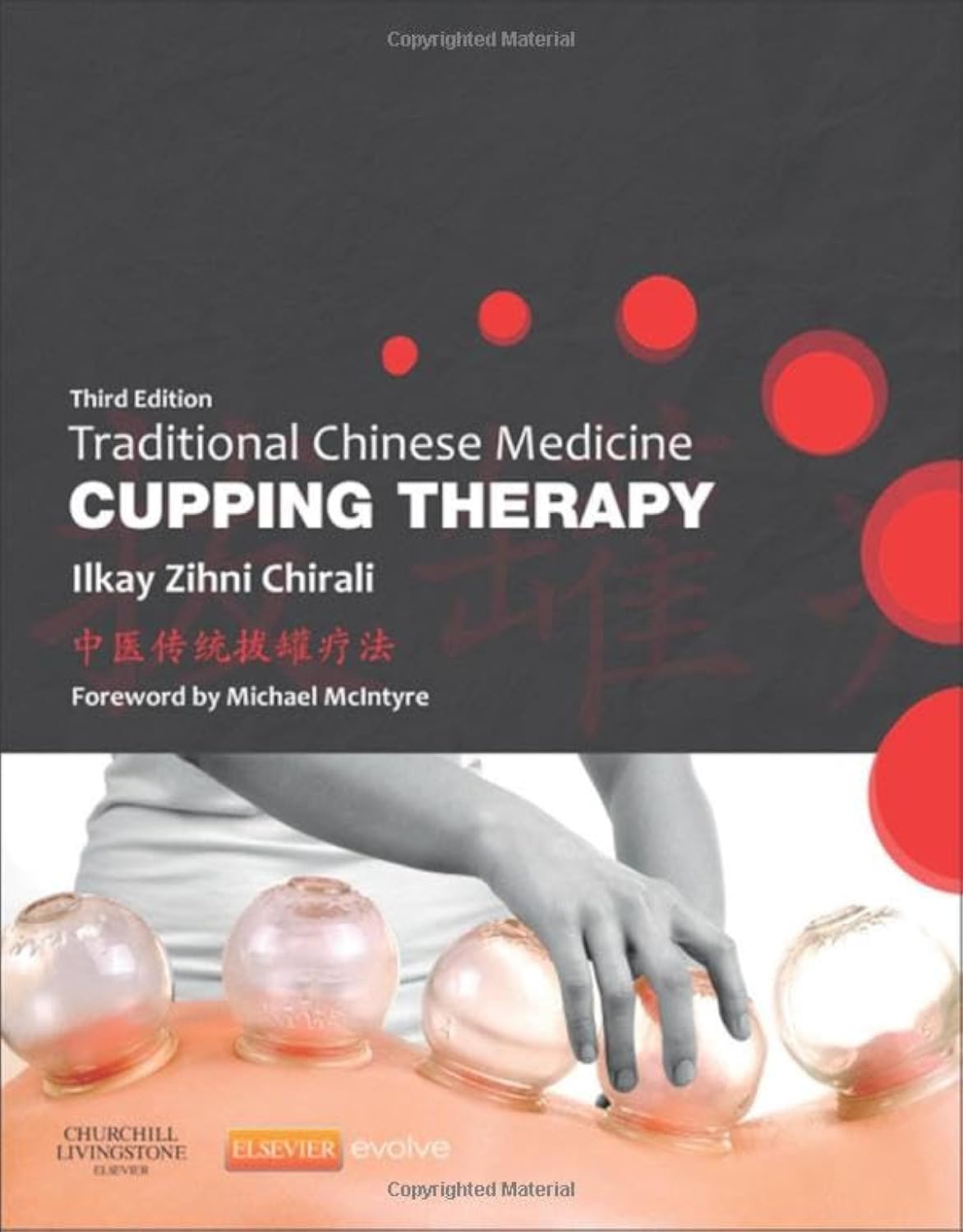 Traditional Chinese Medicine Cupping Therapy