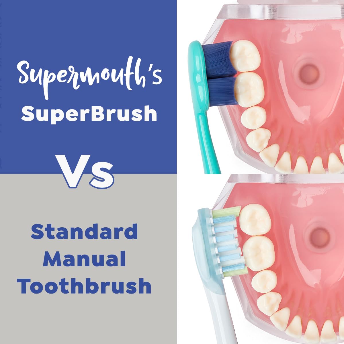 SuperMouth Cepillo de dientes manual SuperBrush: cerdas suaves que se ajustan a las curvas de los dientes para una limpieza profunda, eliminación de placa, dientes sensibles y cuidado de las encías