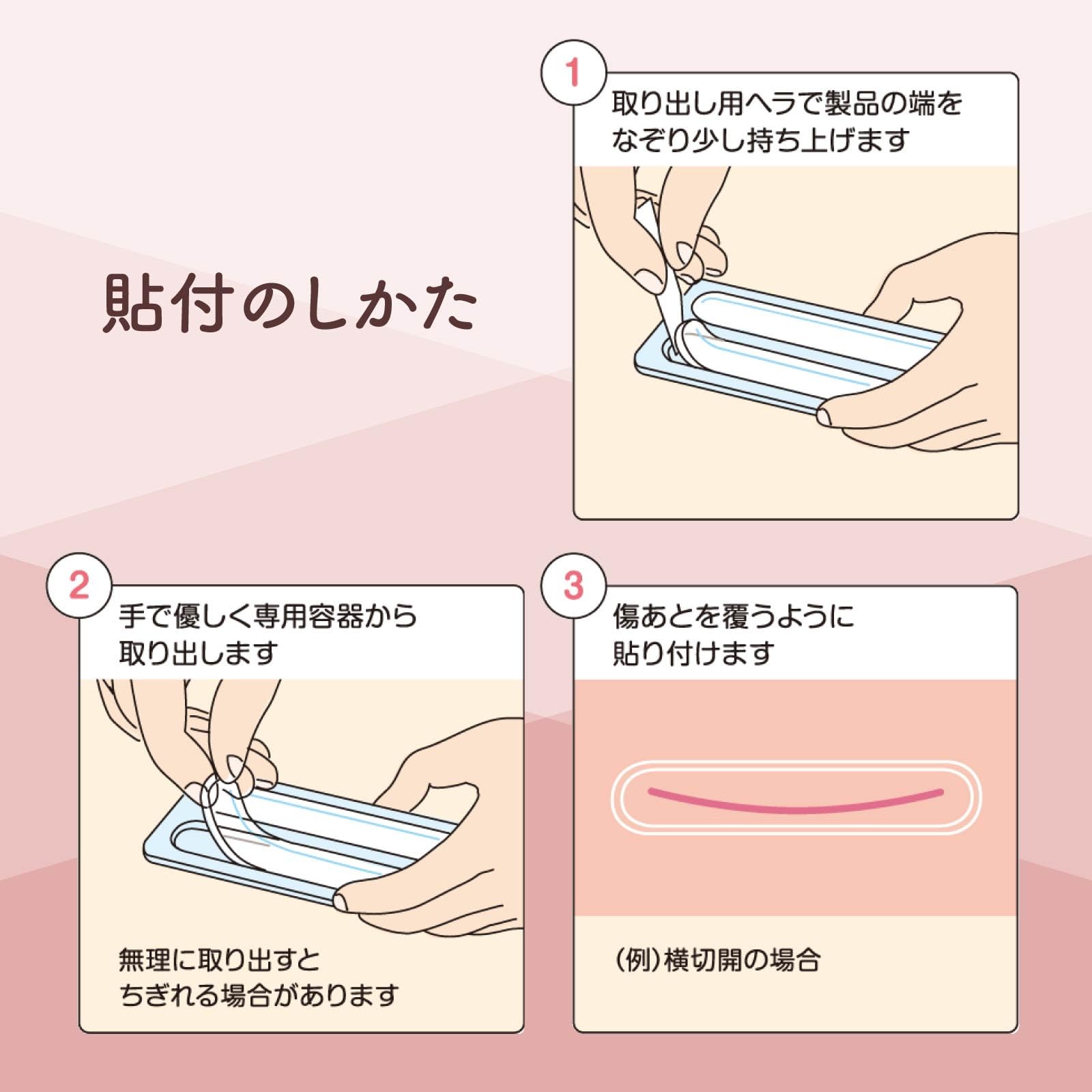 Amazon | Lady Care16 レディケア16 傷あとケアテープ 2枚入り 腹腔鏡
