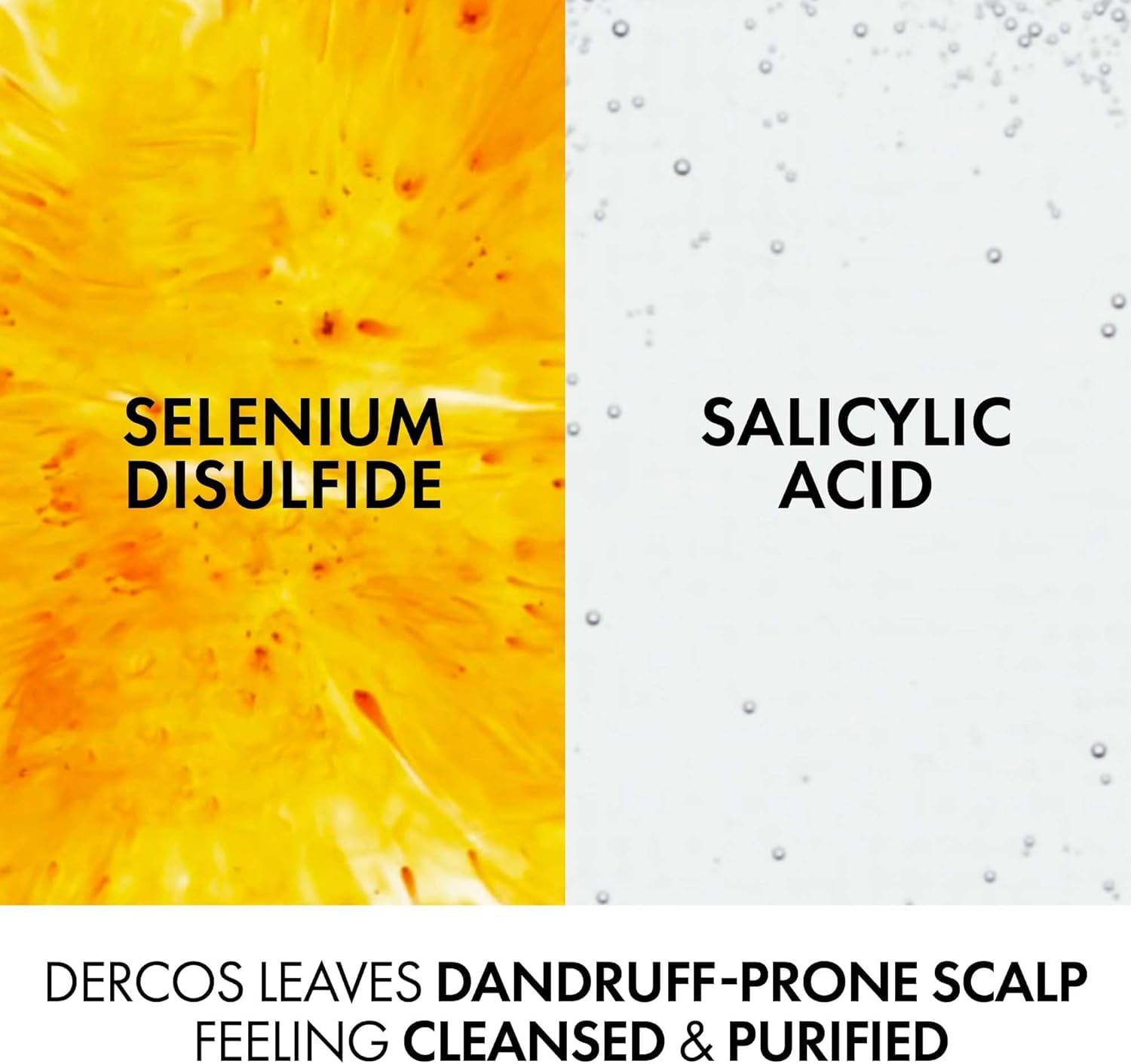 Vichy Dercos Anti-Schuppen-Shampoo Duo Pack – für trockene, juckende Kopfhaut – Anti-Juckreiz & Schuppen reduzierende Formel – 390 ml Flasche + 390 ml Eco Refill
