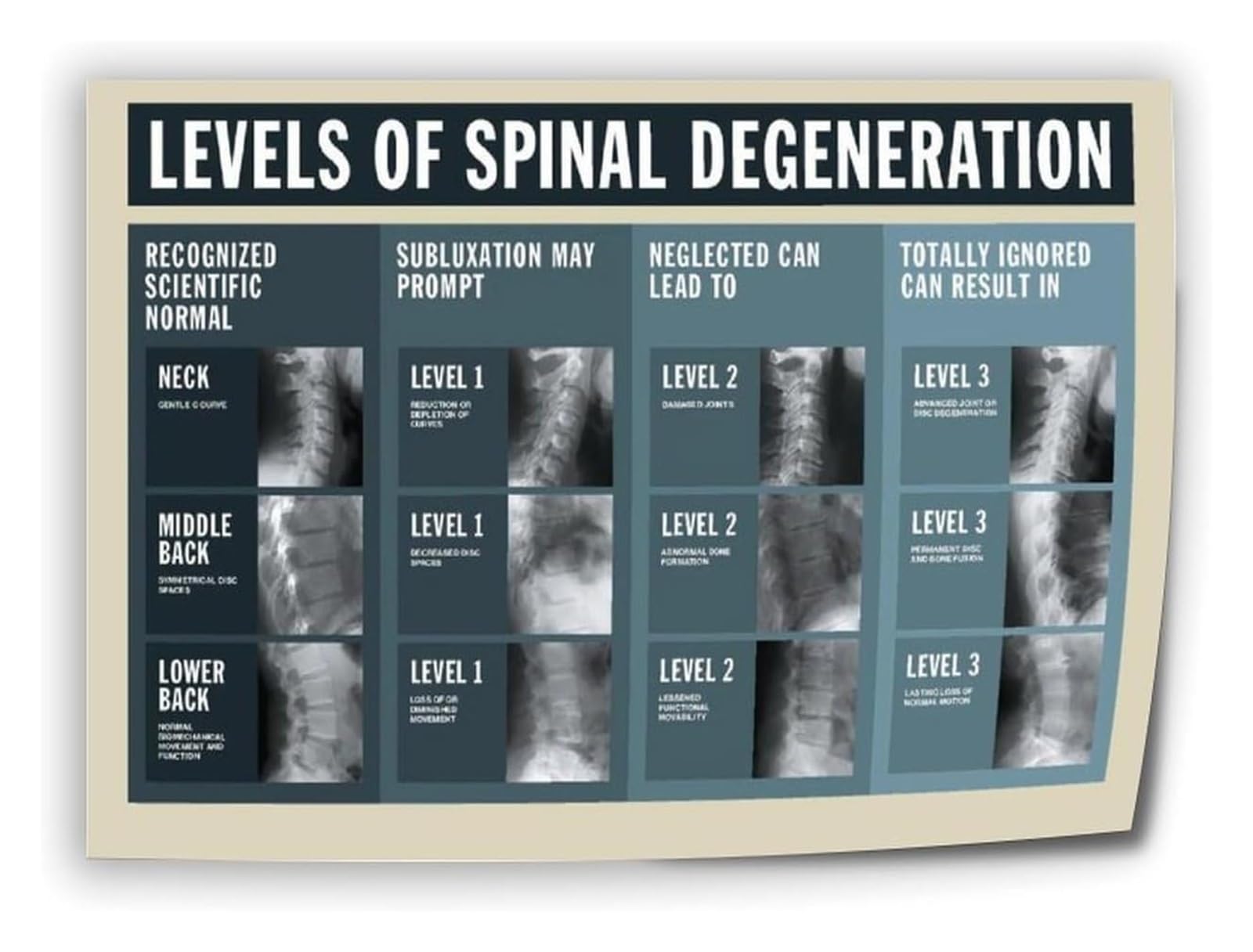HGETJOHXEM Spine Anatomy Art Print - Detailed Diagram of Vertebral Column, Educational Science Wall Decor for Chiropractor Office, Study, Clinic(Framed,08x12inch(20x30cm))