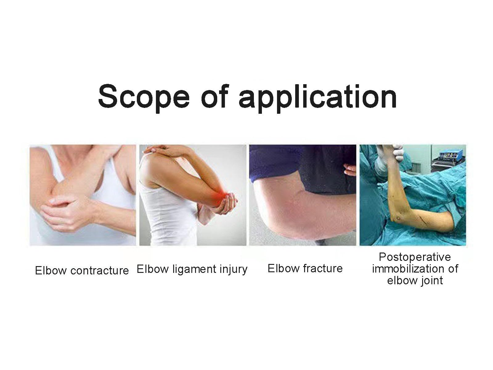 Tutore Fisso per Gomito per Uomo Donna Adulto, Immobilizzatore per Stecca Gomito Regolabile per Lussazione o Lussazione Del Gomito e Lesioni Dei Tessuti Molli, Supporto per Tutore,right