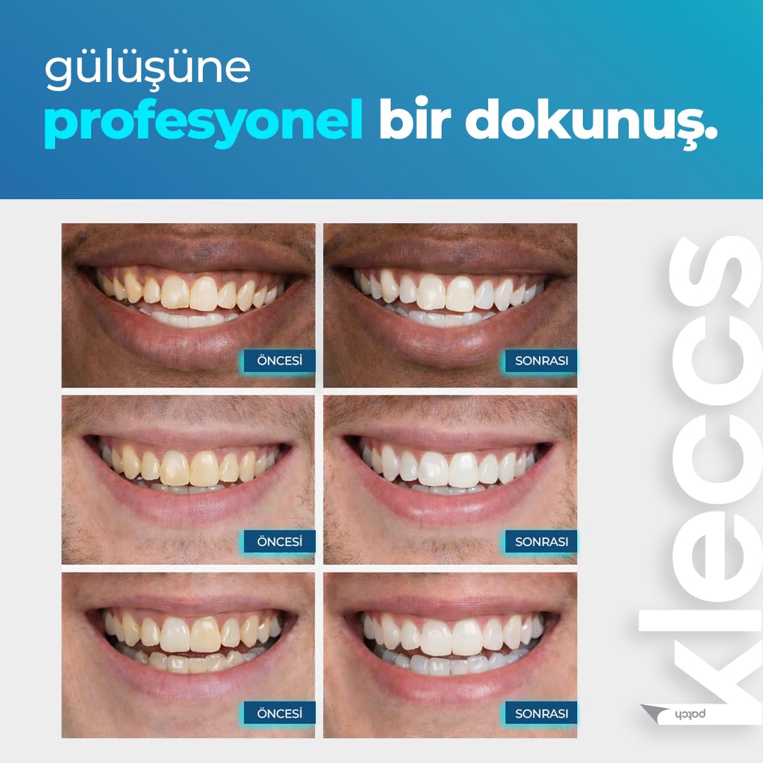 Diş Beyazlatma Bandı, Profesyonel Beyazlık, 14 Paket-28 Bant, Profesyonel Diş Beyazlatma Bandı, Günlük ve Bireysel Kullanıma Uygun