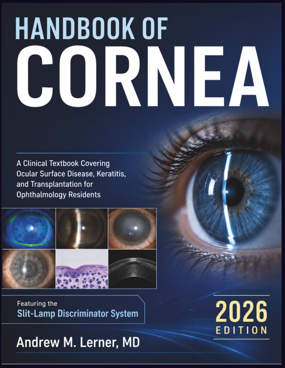Handbook Of Cornea 2026: A Clinical Textbook Covering Ocular Surface Disease, Keratitis, and Transplantation for Ophthalmology Residents