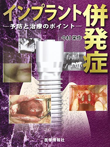 スマホ 無料電子書籍 インプラント併発症―予防と治療のポイント バイ