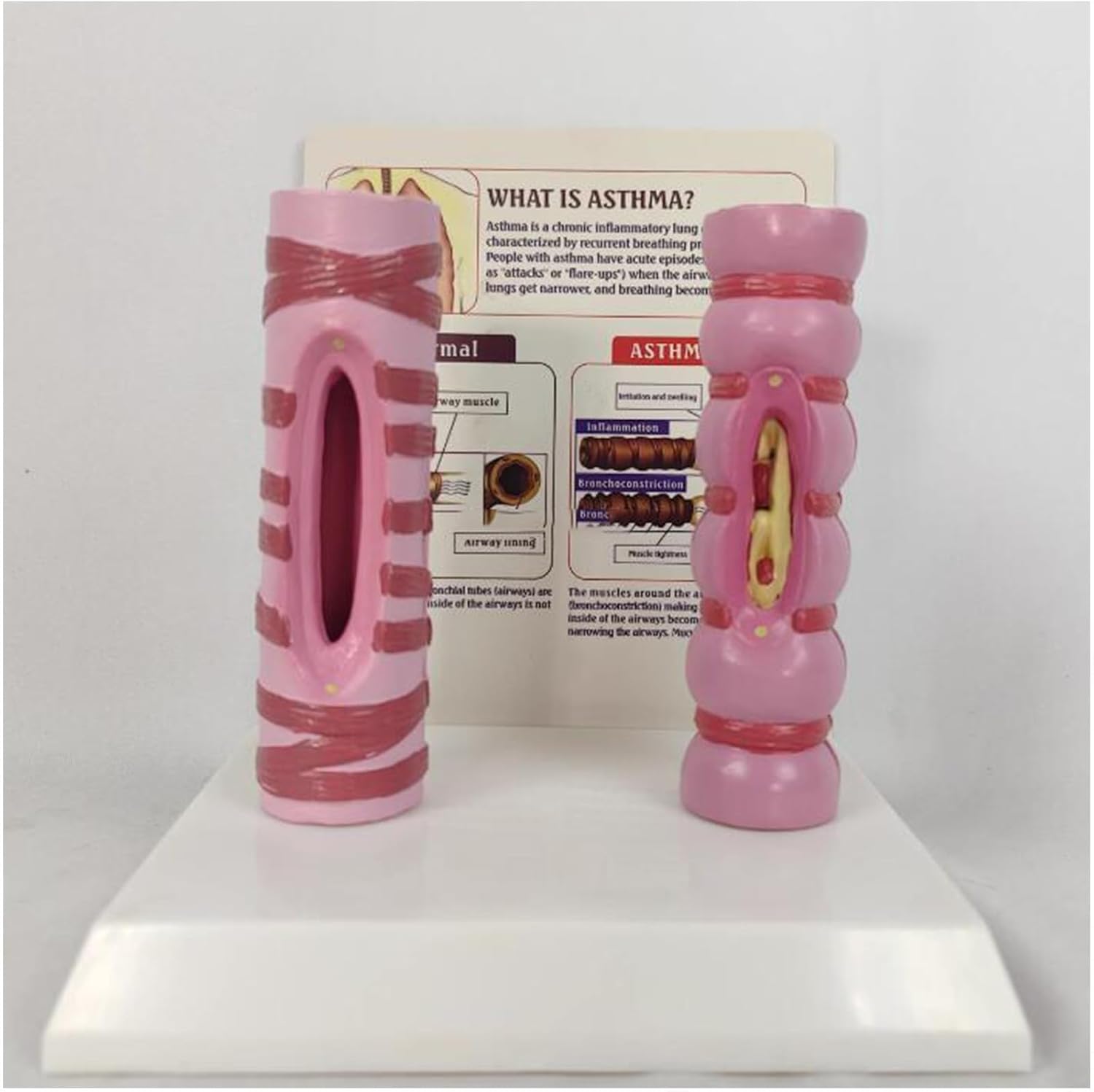 VERIMP Human Trachea Contrast Model Organ Anatomy Respiratory System Structure Human Healthy Trachea and Pathological Comparison Model - Pathology Lung Tube Trachea Comparison Model