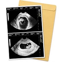 Fake Ultrasound Photo, Fake Pregnancy Scan, Custom Pregnancy Ultrasound Print, Fake Sonogram Picture, Personalized Ultrasound Picture, Prank Pregnancy Scan Photo