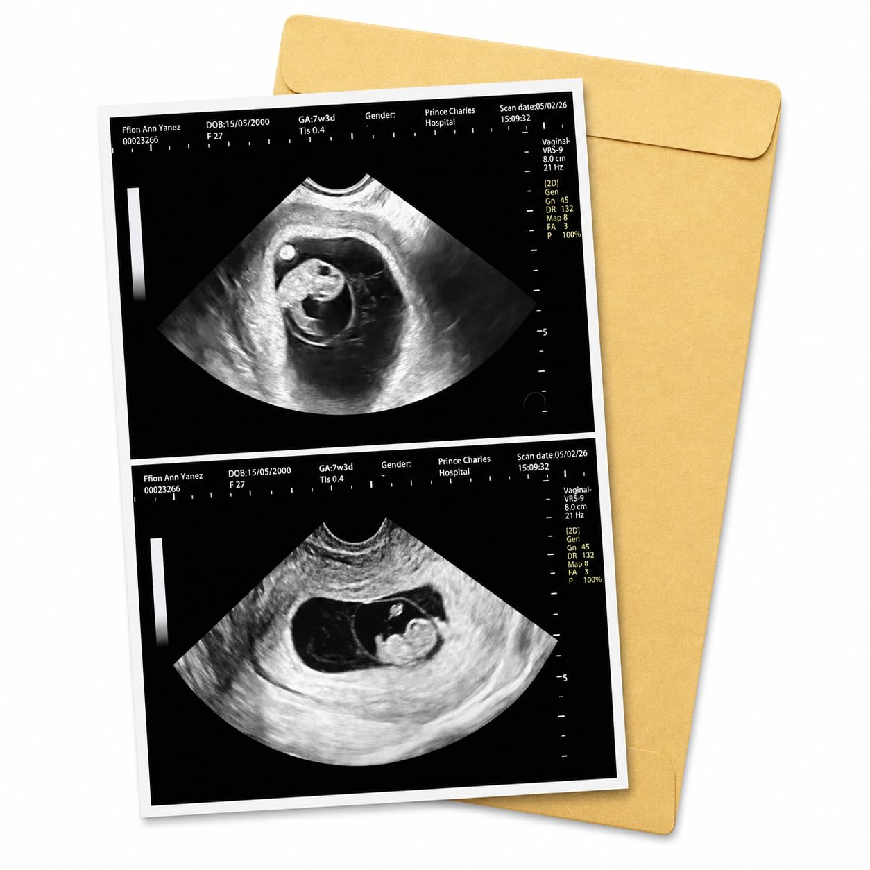 Fake Ultrasound Photo, Fake Pregnancy Scan, Custom Pregnancy Ultrasound Print, Fake Sonogram Picture, Personalized Ultrasound Picture, Prank Pregnancy Scan Photo