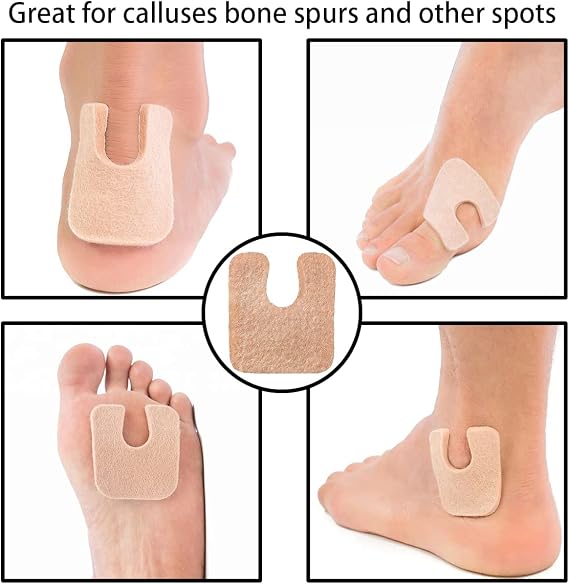 30 Pieces U Shaped Felt Callus Pads Metatarsal Pads Forefoot Foot Pads Pain Relief Foot Cushion Keep Protecting Calluses from Rubbing on Shoes Adhesive Pads for Men and Women