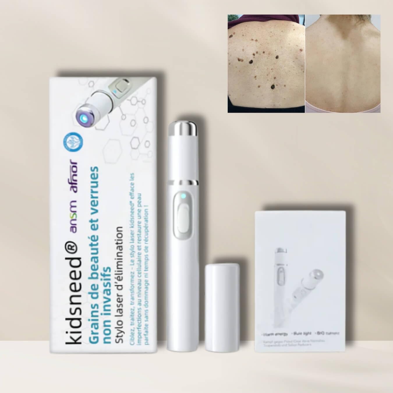derma care Kidsneed 2.0 -Stylo Laser Non-Invasif L'élimination Efficace Des Verrues et Grains de Beauté