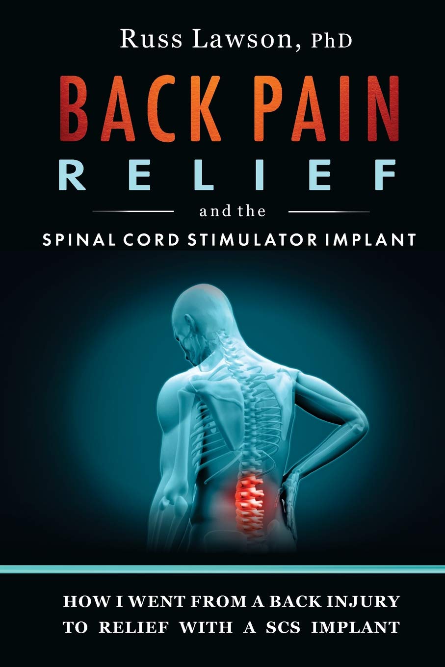 Buy Back Pain and the Spinal Cord Stimulator Im How I Went from a Back