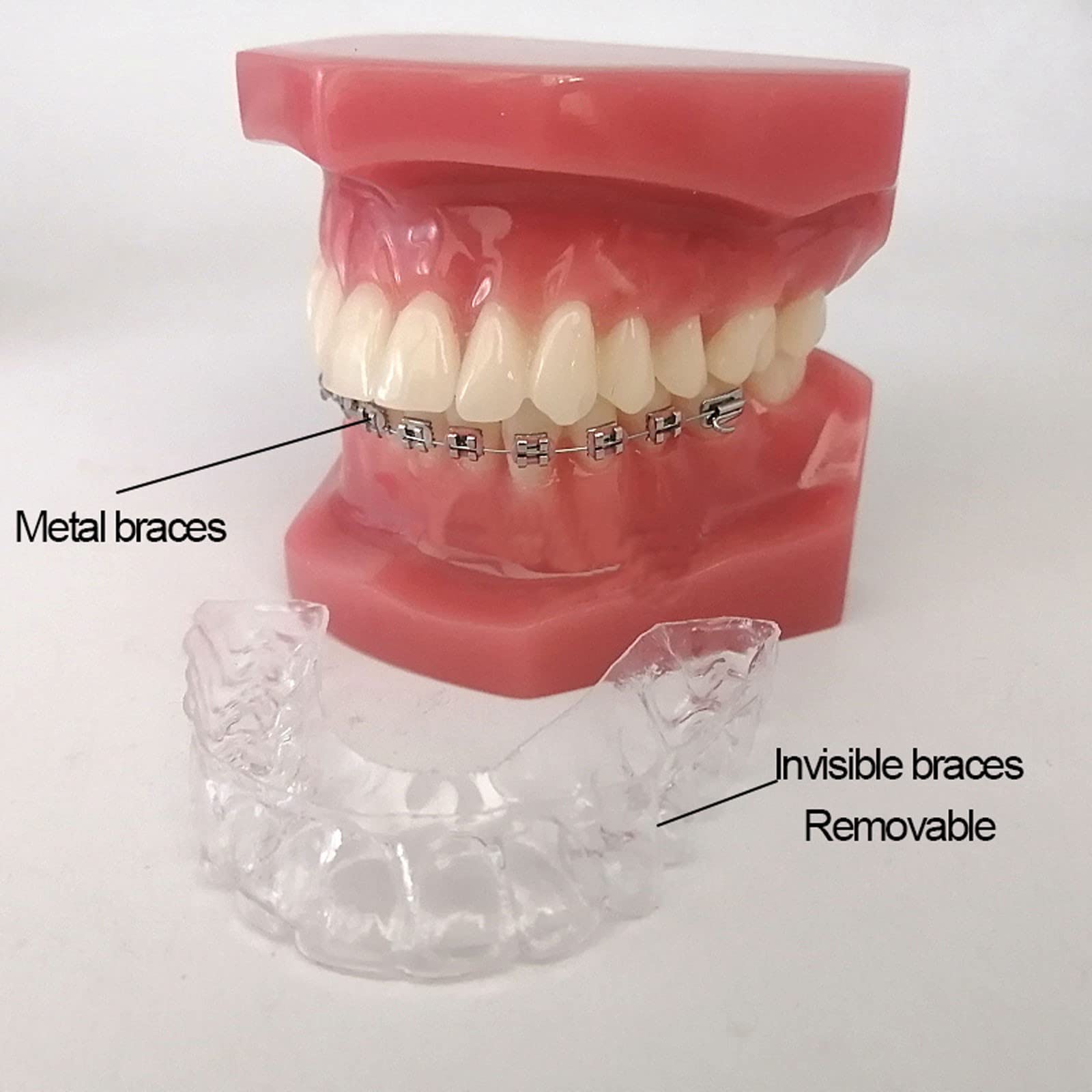 Zahnmodell aus Harz Metall- und Unsichtbares Bracket-Zahnmodell Kieferorthopädisches Zahnmodell für Zahnmedizinisches Lernen Forschen und Lehren