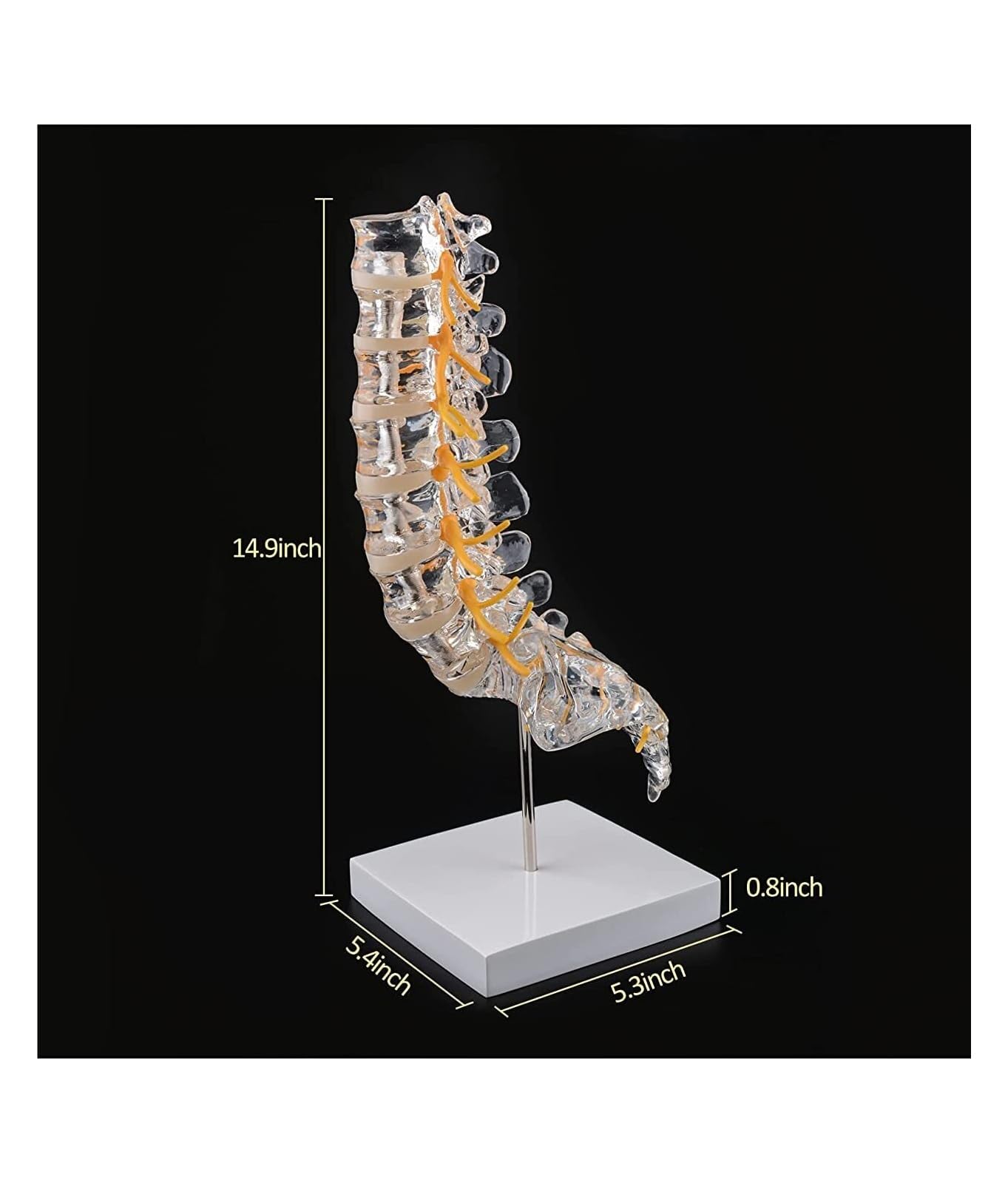 Nervi spinali ed ernia del disco da esporre, modello di colonna vertebrale umana trasparente Modello di colonna vertebrale lombare umana con sacro