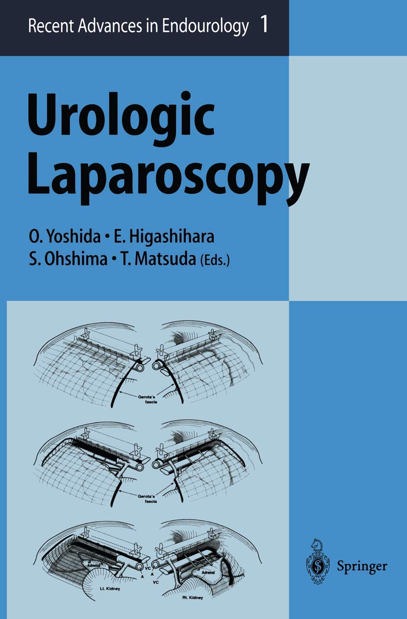 Urologic Laparoscopy (Recent Advances in Endourology) Yoshida， Osamu? Higashihara， Eiji? Ohshima， Shinichi; Matsuda， Tadashi Urologic Laparoscopy: 1 : Yoshida, Osamu, Higashihara, Eiji