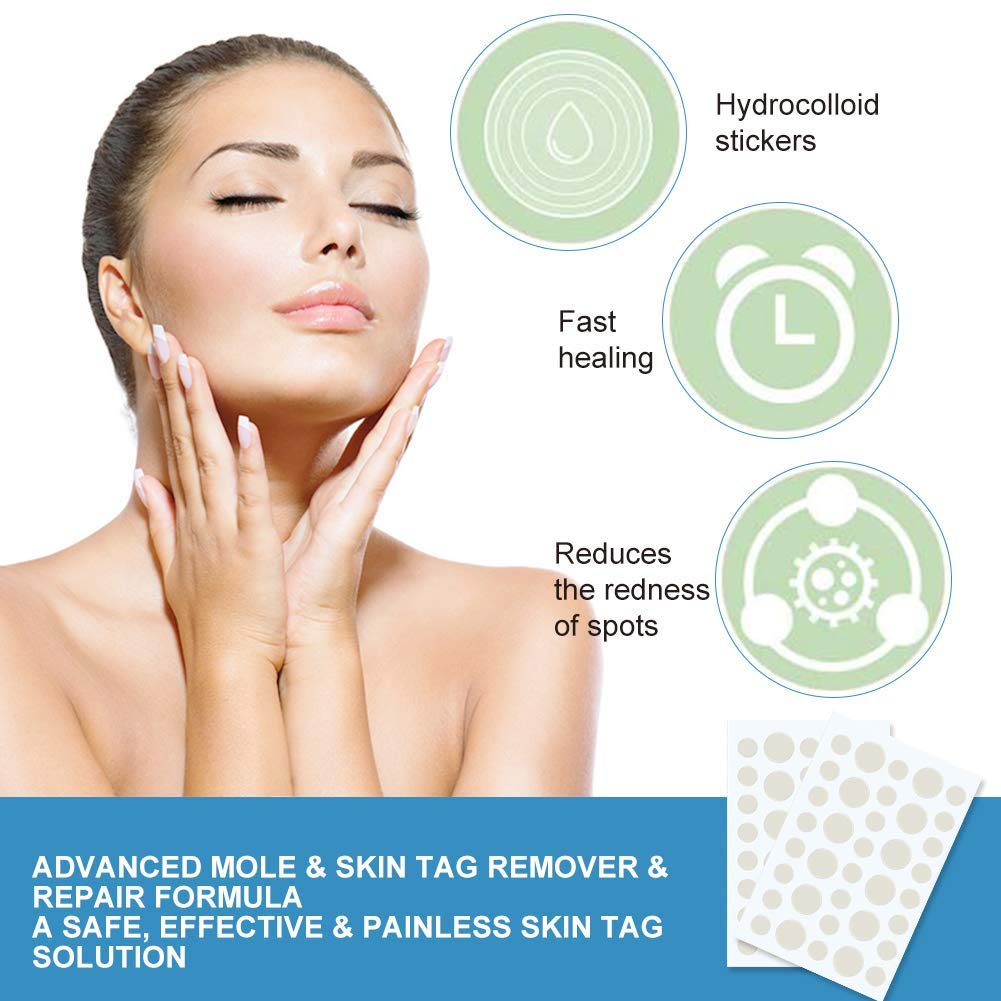 Skin Tag Removal Patches,Mole Remover,Acne Pimple Master Patch,Skin Tag