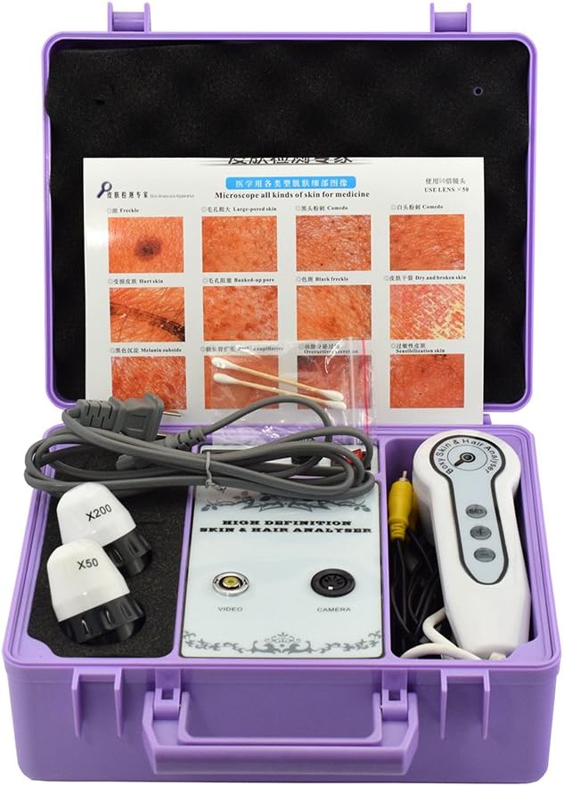 Elitzia Skin and Hair Anaylizer Detector Hair Analyzer connecting to TV Monitor Magnified 50 Times On Skin 200 Times On Scalp Bacterial Infection Hair Follicle