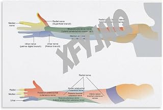 Cervical Radiculopathy Poster Pinched Nerve, Pain Pathways And Symptoms (7) Canvas Painting for Living Room Bedroom Decor 18x12inch(45x30cm) Unframe-style