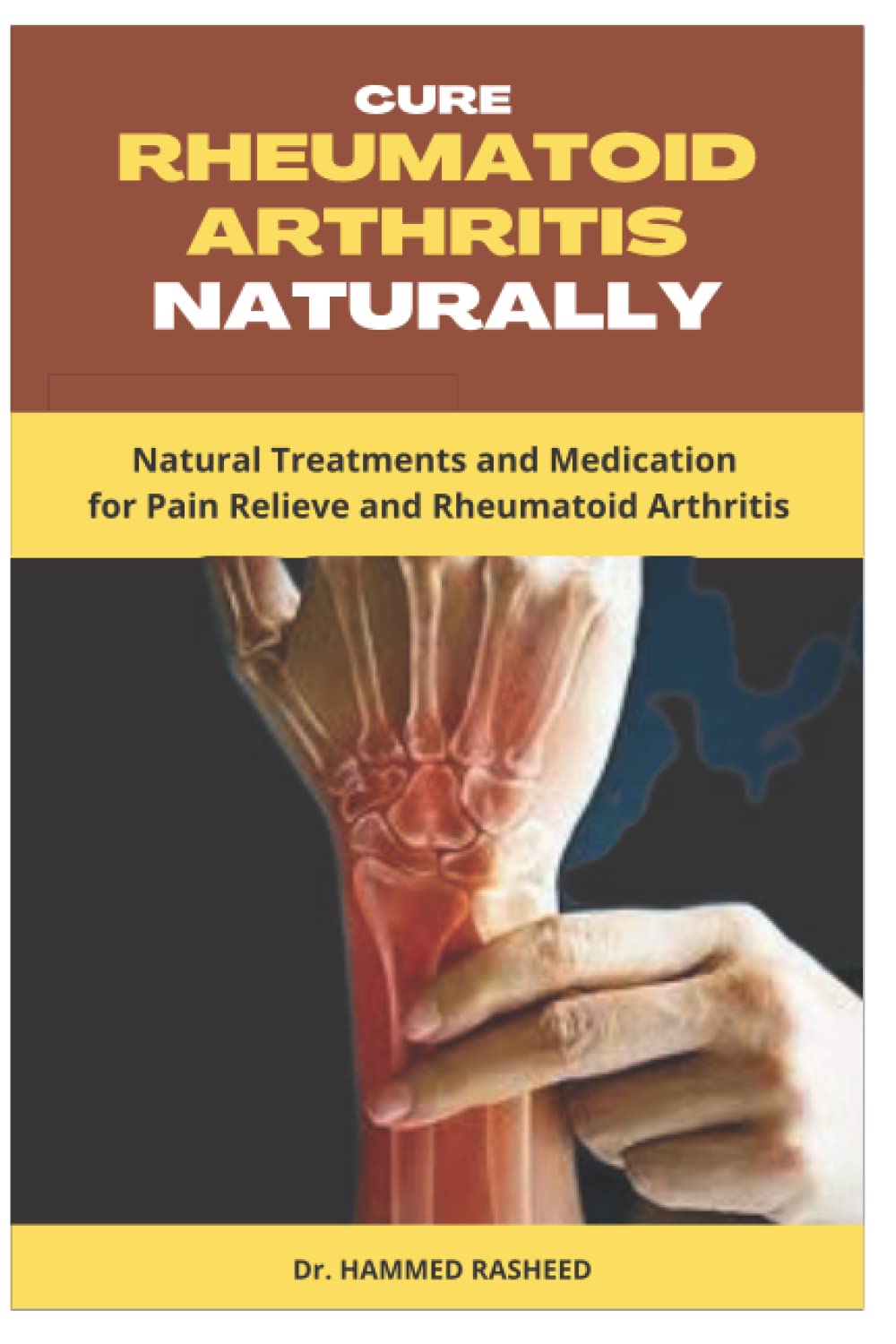 CURE RHEUMATOID ARTHRITIS NATURALLY: Natural Treatments and Medication for Pain Relieve and Rheumatoid Arthritis