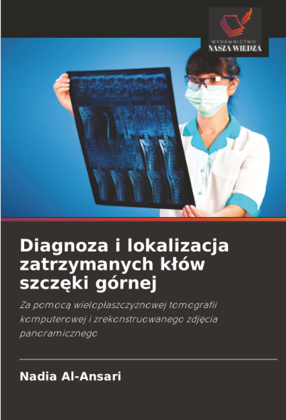 Diagnoza i lokalizacja zatrzymanych klów szczęki górnej: Za pomoc¿ wielop¿aszczyznowej tomografii komputerowej i zrekonstruowanego zdj¿cia panoramicznego