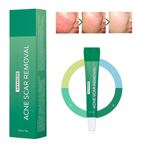 Tratamiento avanzado de manchas de acné para la cara retinol alantoína vitamina E betaína gel de cicatrices rejuvenecedor cuidado suave de la piel