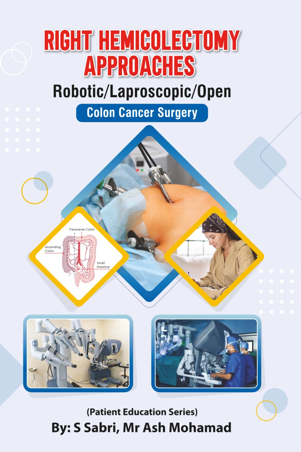 Right Hemicolectomy Approaches (Robotic/Laparoscopic /Open): Colon Cancer Surgery