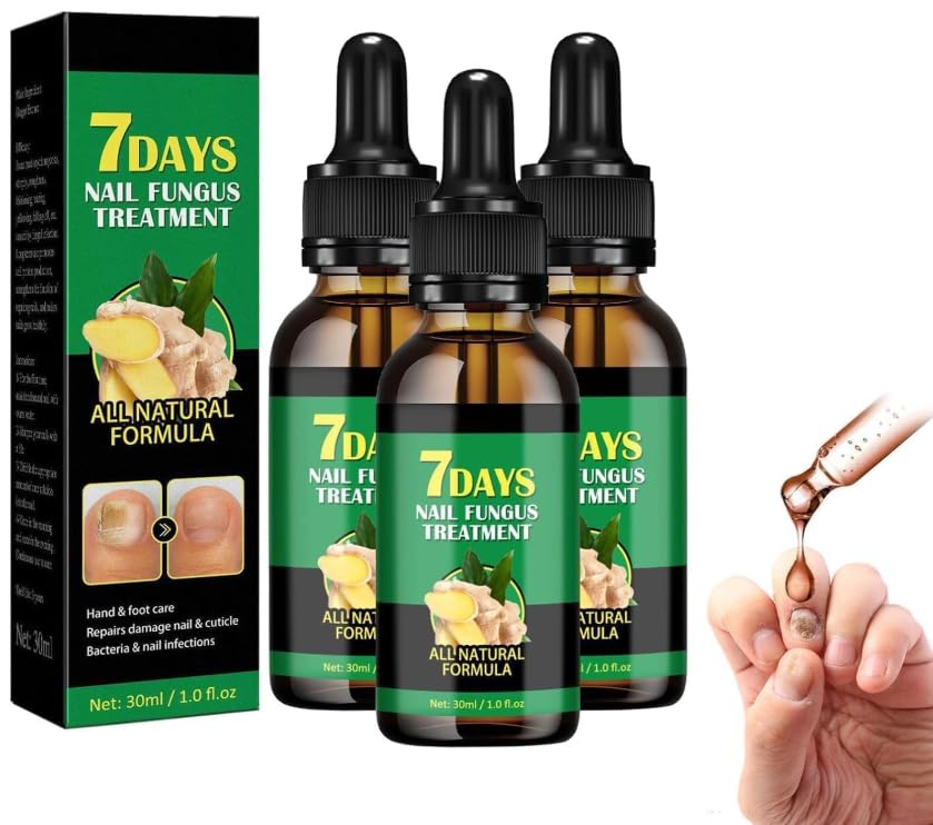 Tratamiento para Hongos en las Uñas, Tratamiento para Hongos en las Uñas de 7 Días, Sérum de Jengibre para Crecimiento de Uñas, Aceite para el Cuidado de las Cutículas de las Uñas de los Pies (3 uds)