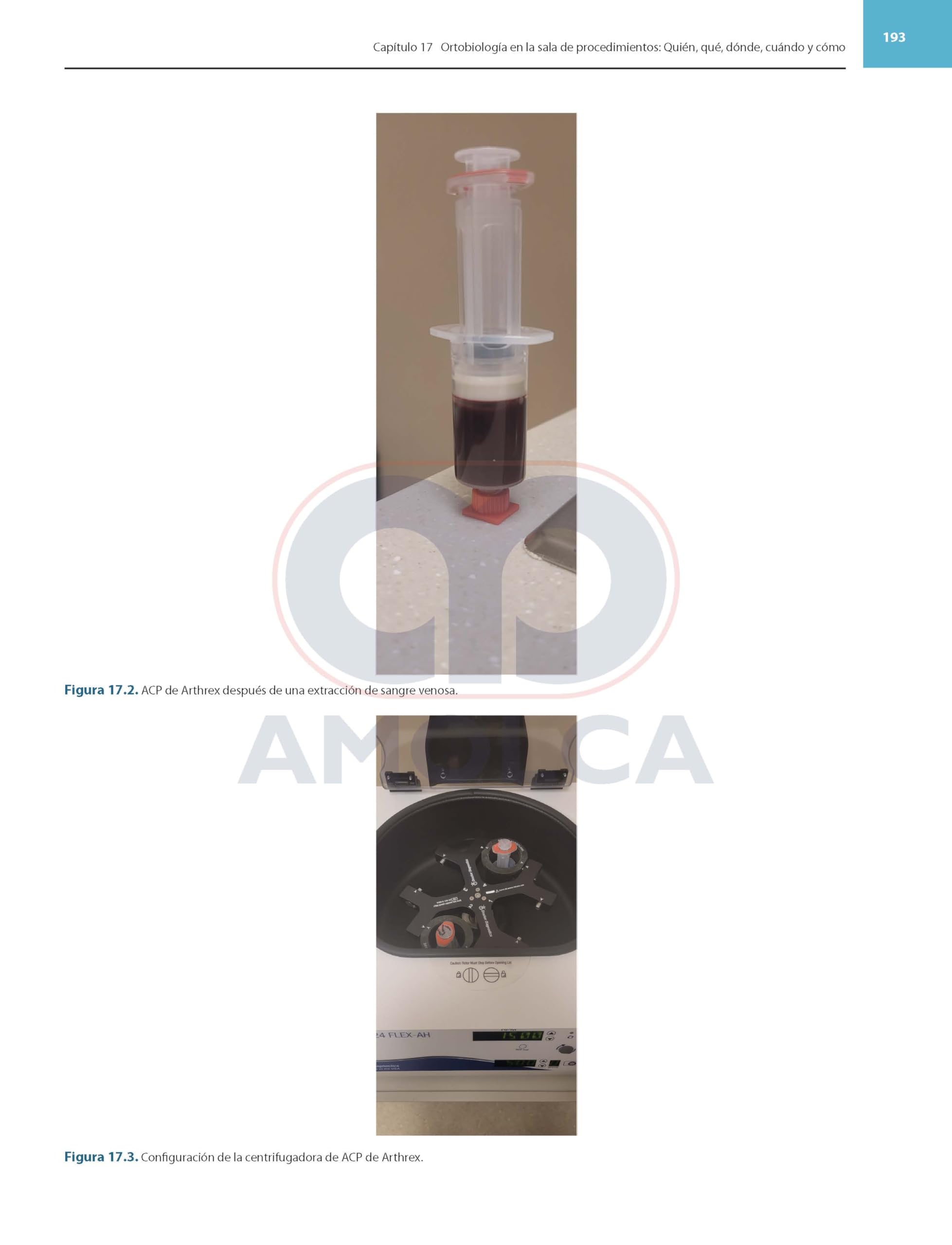 Ortobiologicos avances y aplicaciones clinicas en medicina